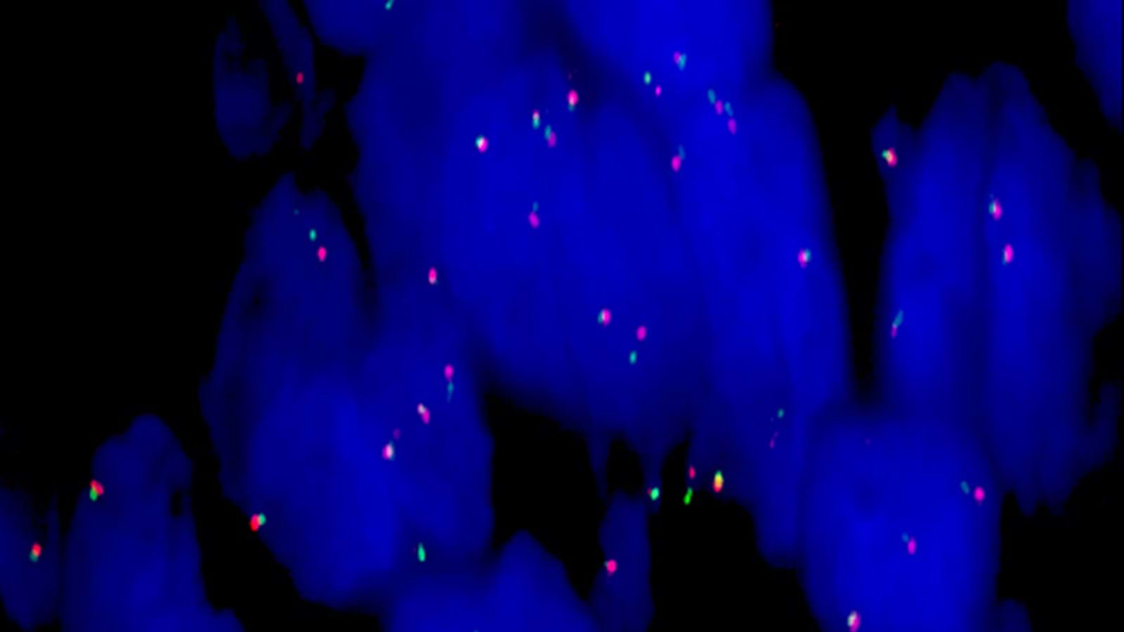 IVD ROS1 Break XL For BOND ISH