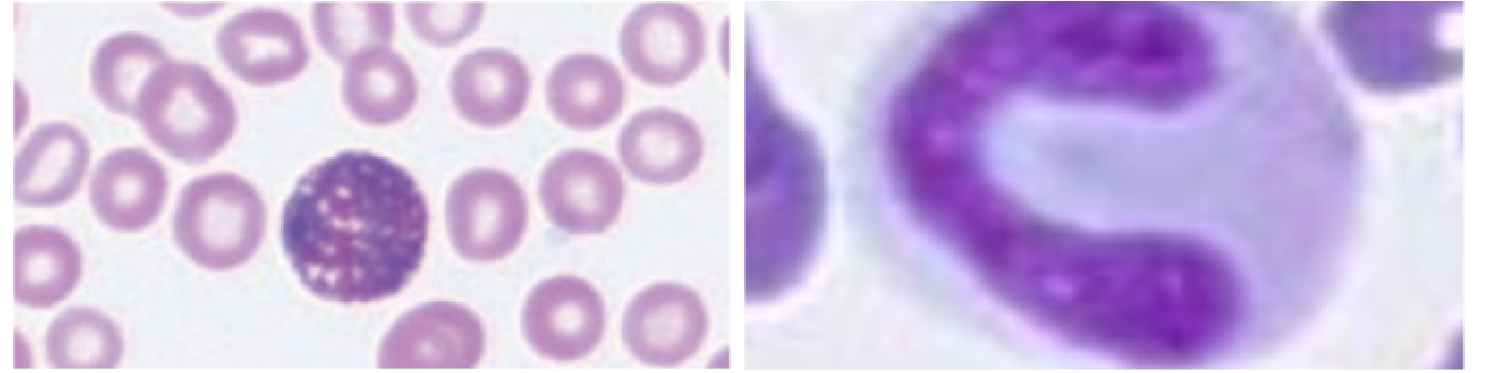 Bilde av eosinofil granulocytt hos hund og band neutrofil hos katt