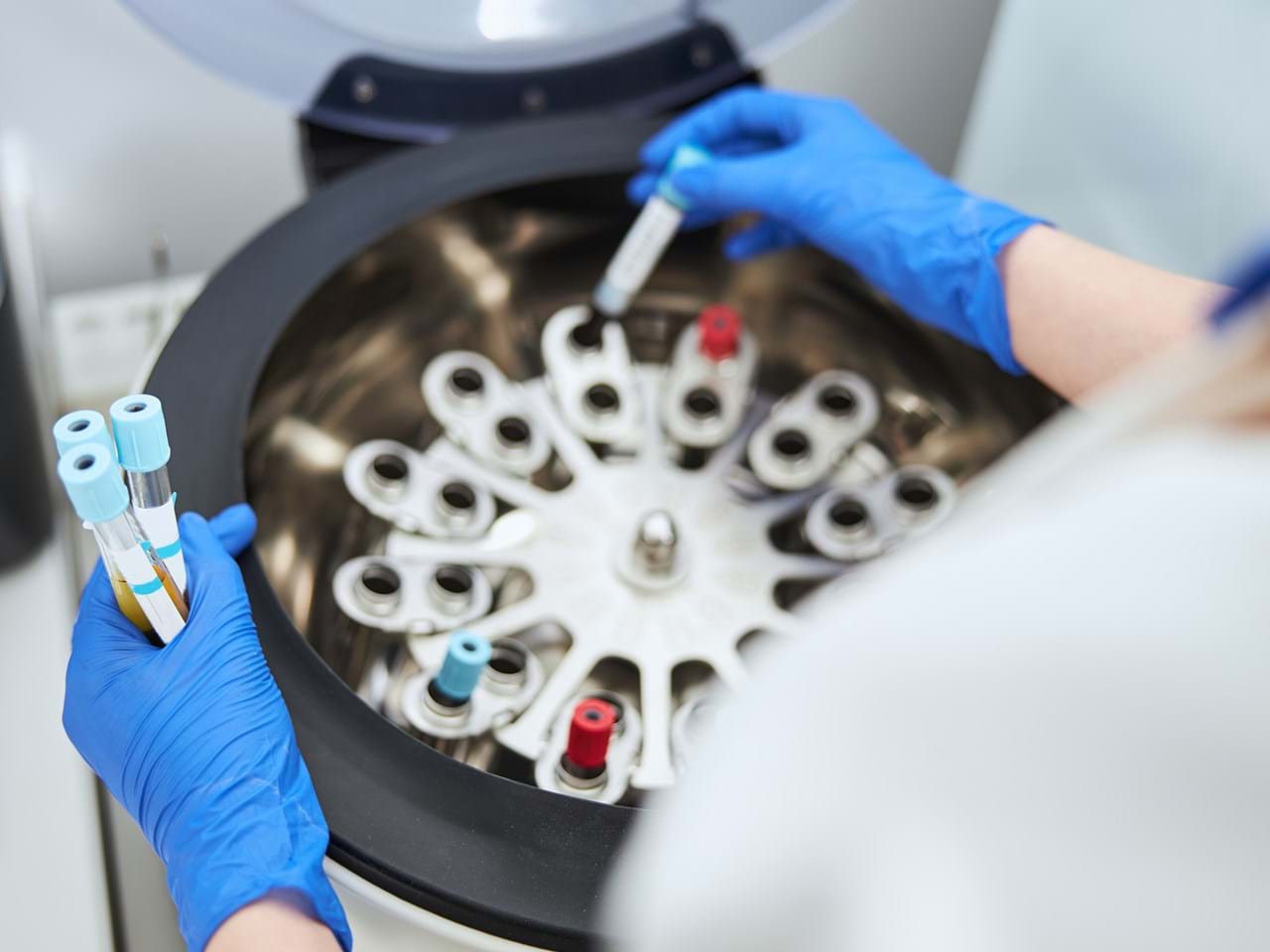 Laboratoriepersonell håndterer blodprøver i en sentrifuge
