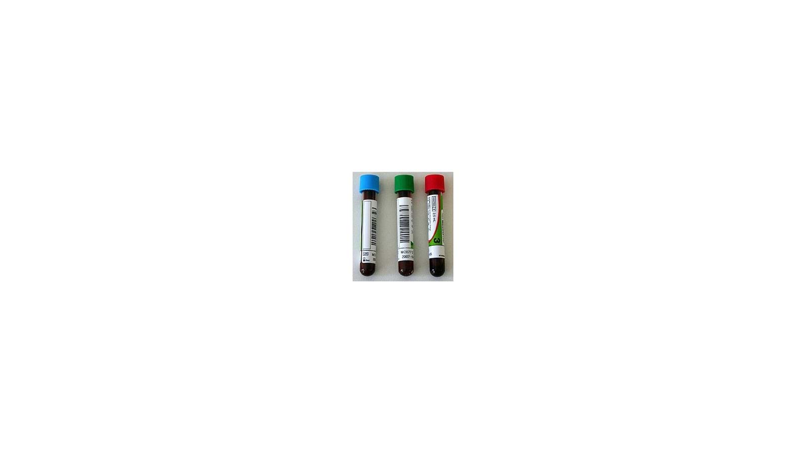Normal Abx ABX Minotrol 16 - Normal - triolab.no
