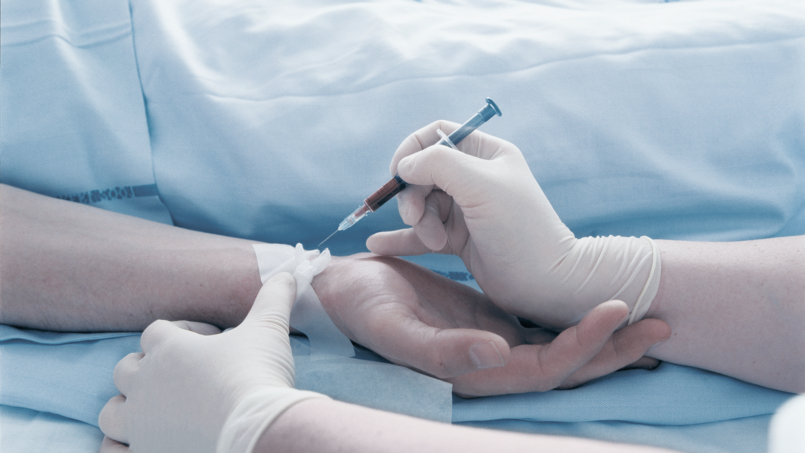 Safepico Aspirator Samplers Hospital Syringe Patient Blood Sample